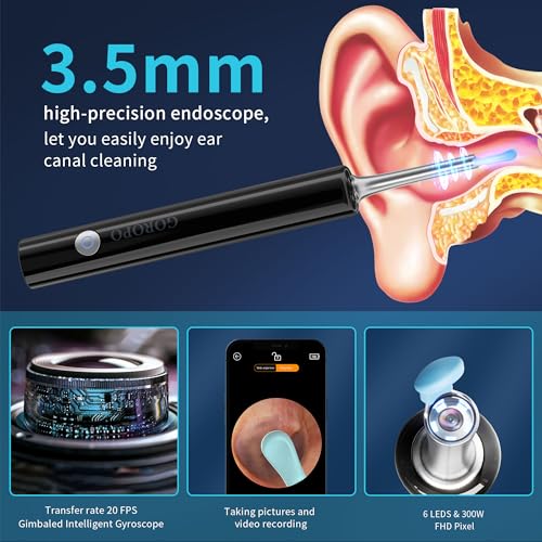 White Wireless Ear Otoscope Kit with 4 Ear Pick & 6 LED Lights Q6751