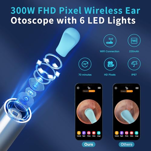 White Wireless Ear Otoscope Kit with 4 Ear Pick & 6 LED Lights Q6751