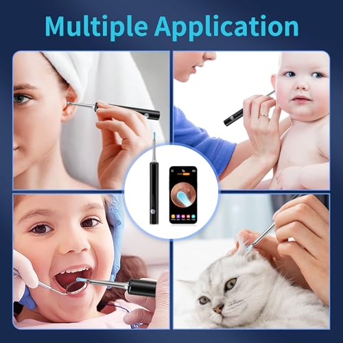 White Wireless Ear Otoscope Kit with 4 Ear Pick & 6 LED Lights Q6751