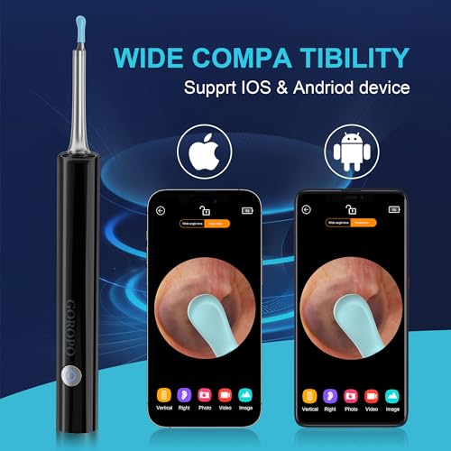 White Wireless Ear Otoscope Kit with 4 Ear Pick & 6 LED Lights Q6751