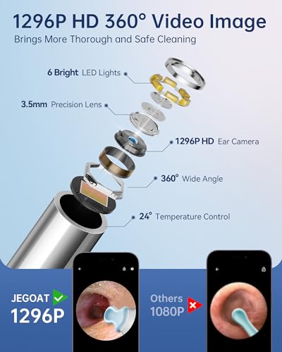 Ear Cleaner with Camera, 6 LED Lights and 10 Ear Picks Z7036