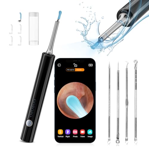 White Wireless Ear Otoscope Kit with 4 Ear Pick & 6 LED Lights Q6751